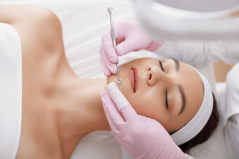 Venus Beauty Century acne treatment
